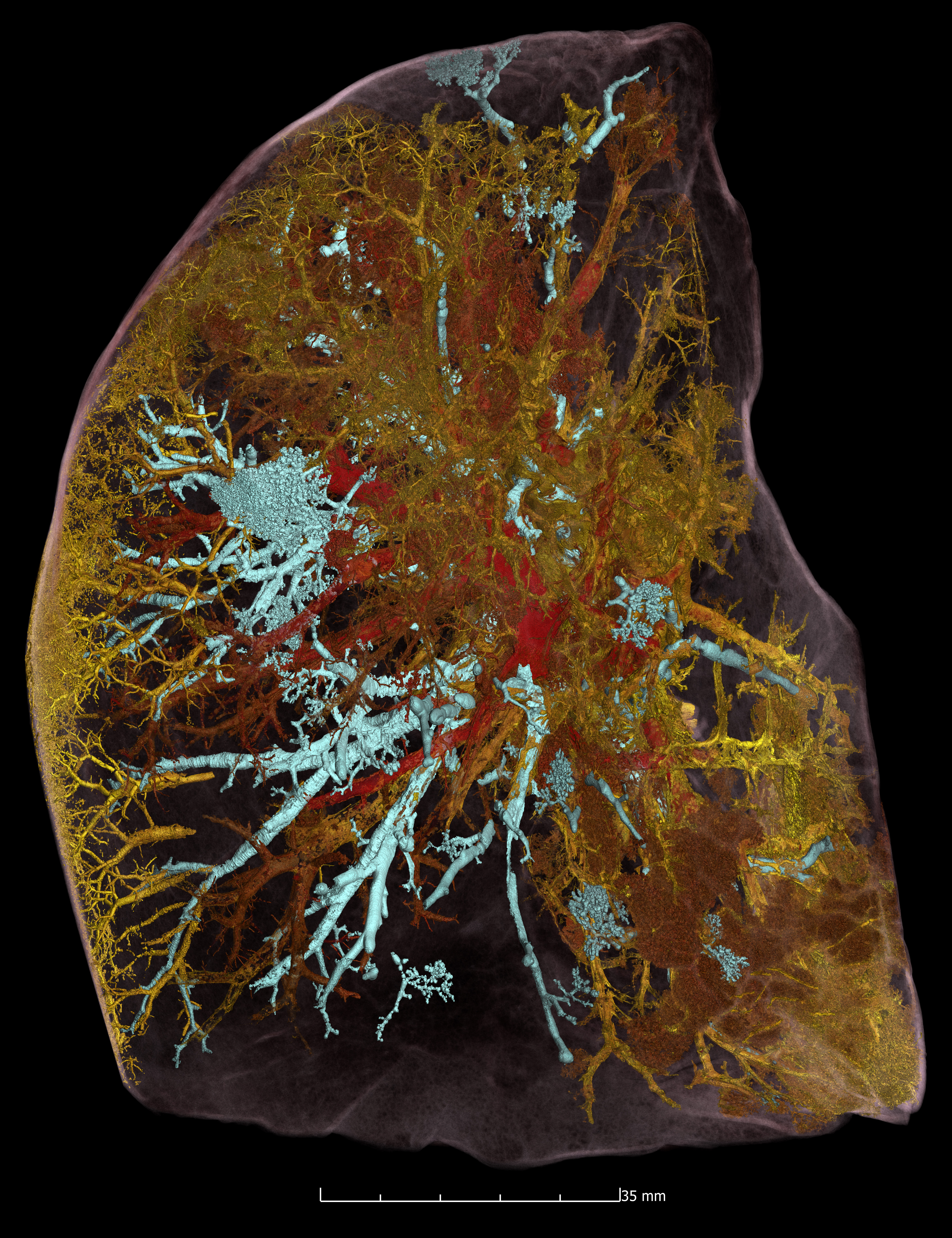 In-situ synchrotron imaging activities applied to help better understand the damage COVID-19 can do to our organs.  (cover image)