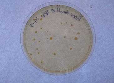 An image showing the Hidden ecosystem of the microbes on a door handle, discussed at a Pint of Science event in 2019 - An image showing the Hidden ecosystem of the microbes on a door handle discussed at a Pint of Science event in 2019